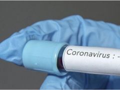 ‘Koronavirüsü İzole Ettik’
